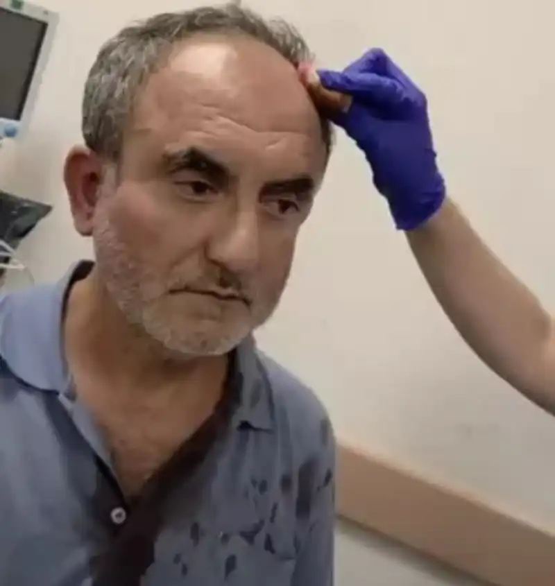 SANTRAL HUKUKEN KAPATILDI, ARDINDAN SALDIRI GELDİ!